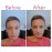 NOVAGE Skin Renewing Peel