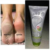 FEET UP Advanced Cracked Heel Repair & Smooth Foot Cream